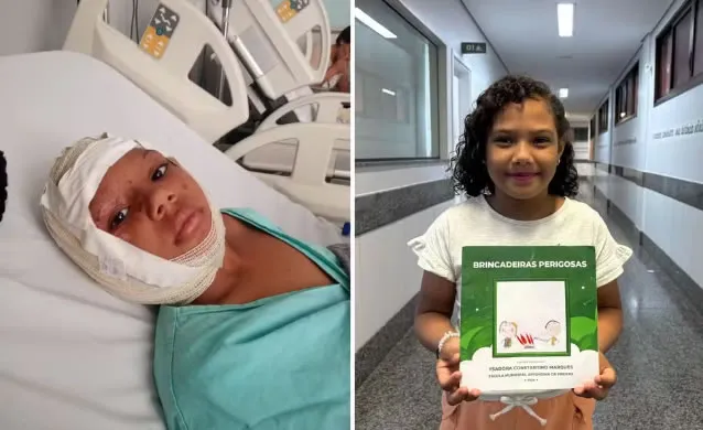 Criança que sofreu queimadura no rosto durante brincadeira supera trauma e escreve livro: ‘Dias de muita luta’
