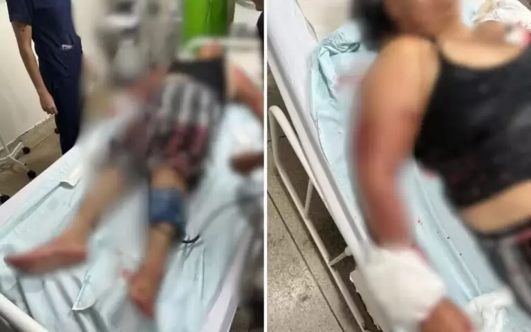 Avó atacada por pitbull isolou neta bebê e precisou trancar porta para evitar mordidas em Goiás, diz polícia