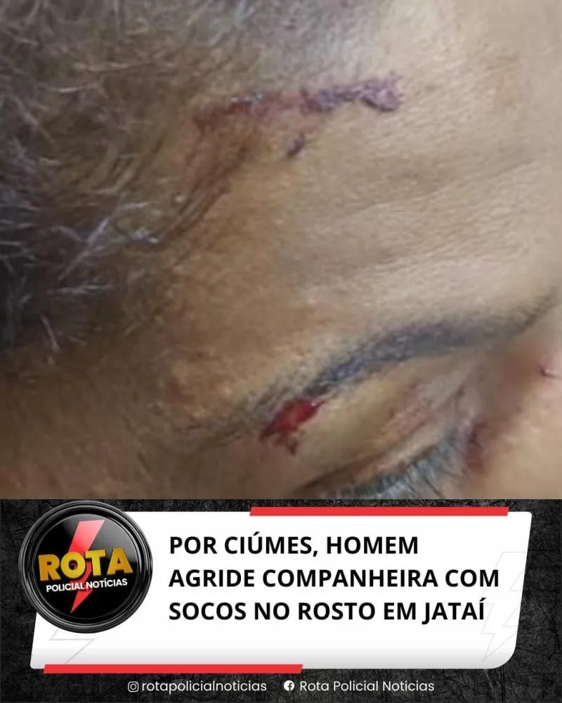 POR CIÚMES, HOMEM AGRIDE COMPANHEIRA COM SOCOS NO ROSTO EM JATAÍ