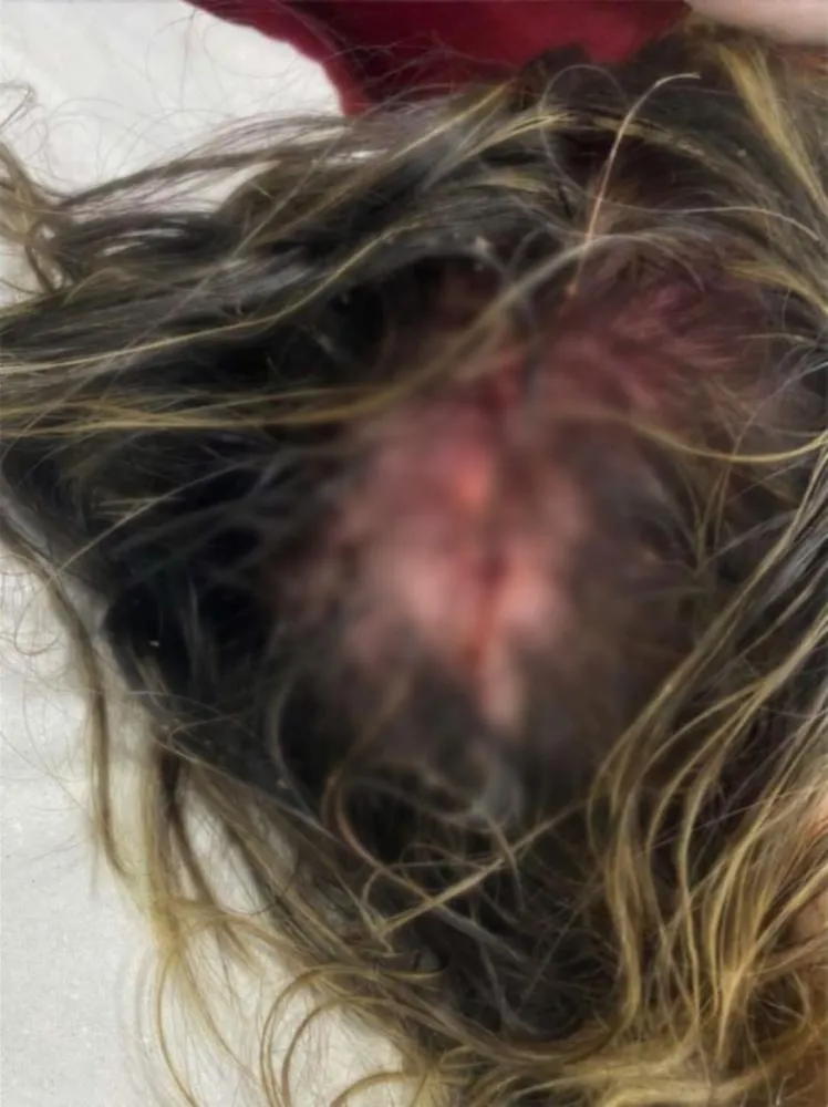 POLÍCIA CIVIL DE SERRANÓPOLIS REALIZA PRISÃO DE HOMEM QUE BATEU A CABEÇA DA NAMORADA VÁRIAS VEZES CONTRA O CHÃO